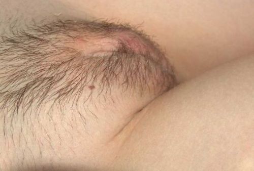 Hairy — 21