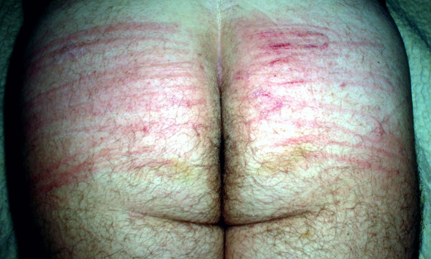 Hard spanking, for cucky, with electric cable. — 10